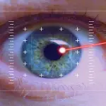 Chirurgia Refrattiva con Laser: cos’è e come funziona