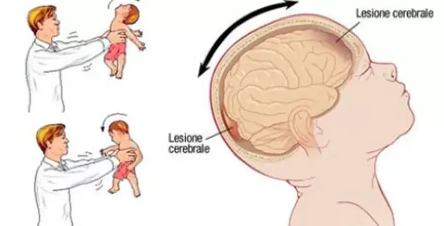 ATTENZIONE, NON GIOCARE MAI PIU´ CON UN BAMBINO, GETTANDOLO IN ARIA, PUO´ ESSERE MORTALE...