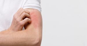 Allergie e intolleranze alimentari: similitudini e differenze allergia